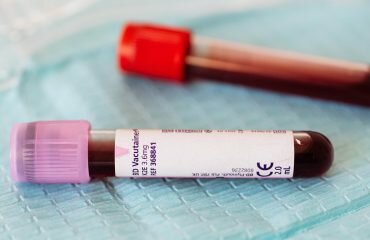 Hemograma: qual o seu papel nas doenças cardiovasculares?