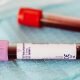 Hemograma: qual o seu papel nas doenças cardiovasculares?
